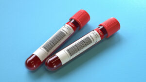 Tube rempli de sang en laboratoire pour analyse médicale, symbole de diagnostic avancé.